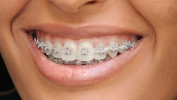 Best Orthodontist in Ahmedabad